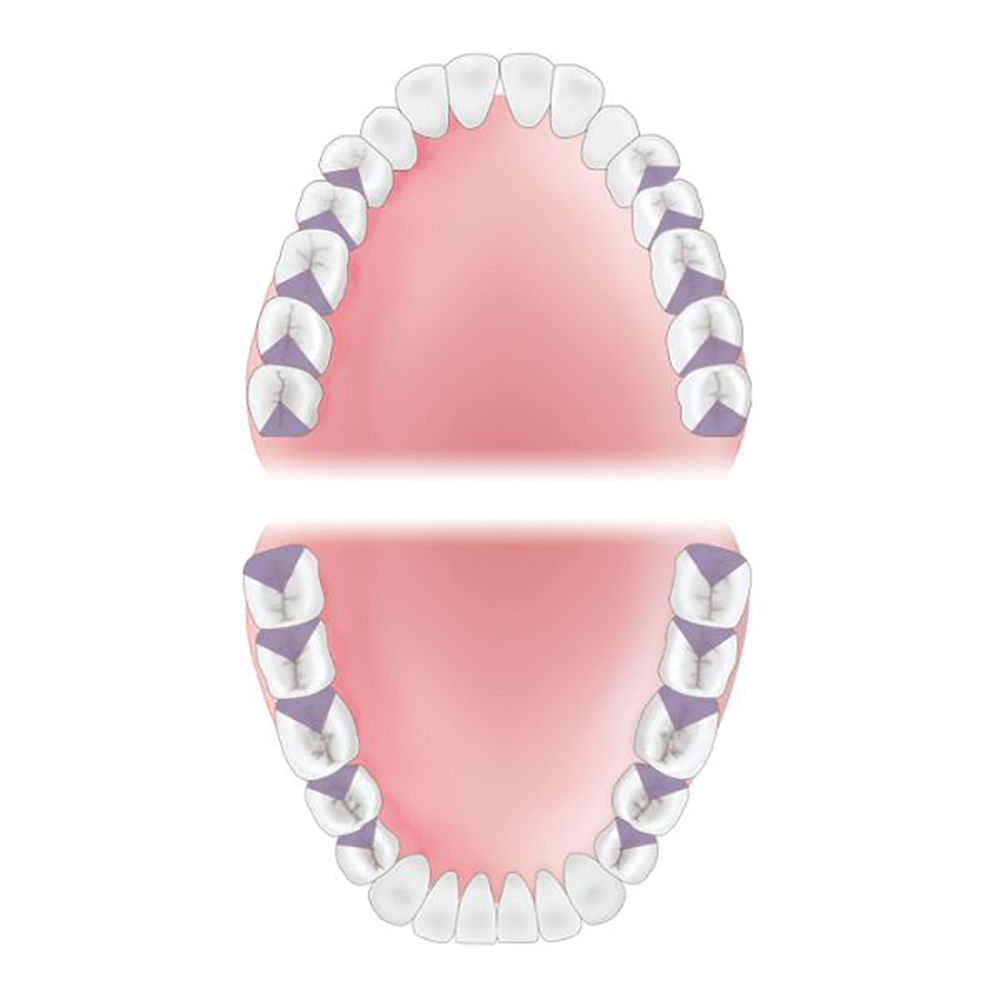 Distal Areas of Mouth
