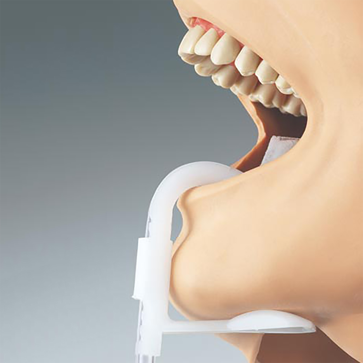 Lingua Fix Saliva Ejectors