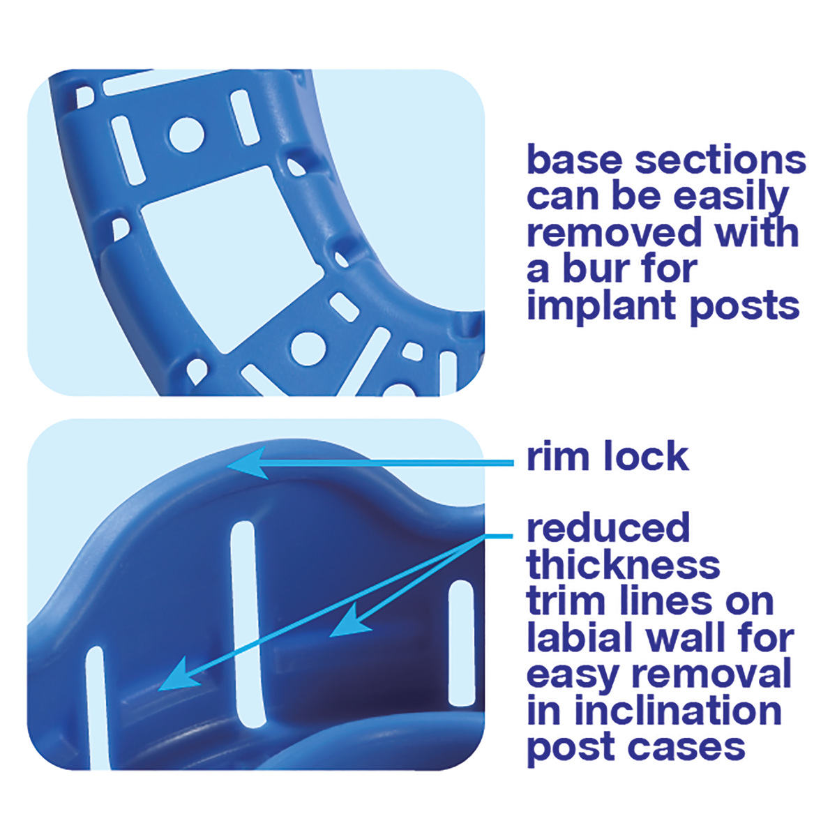 Tray Features