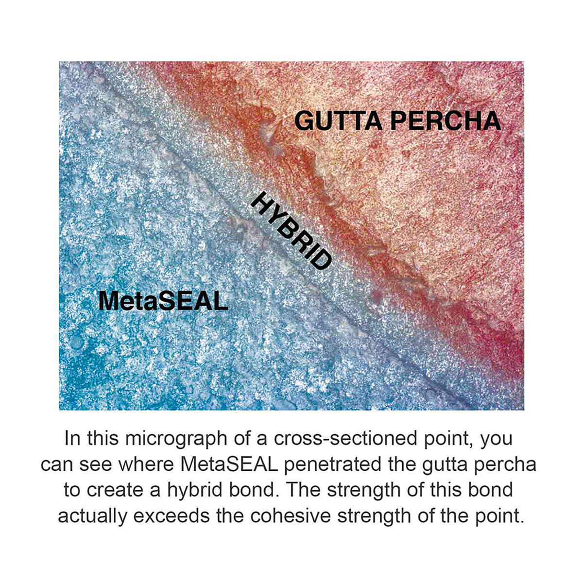 Micrograph of MetaSEAL