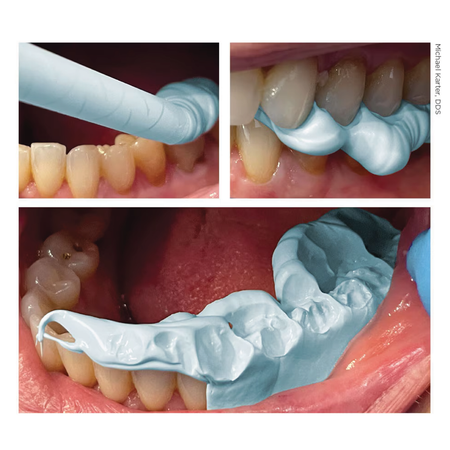 Blu-Mousse Inside the Mouth