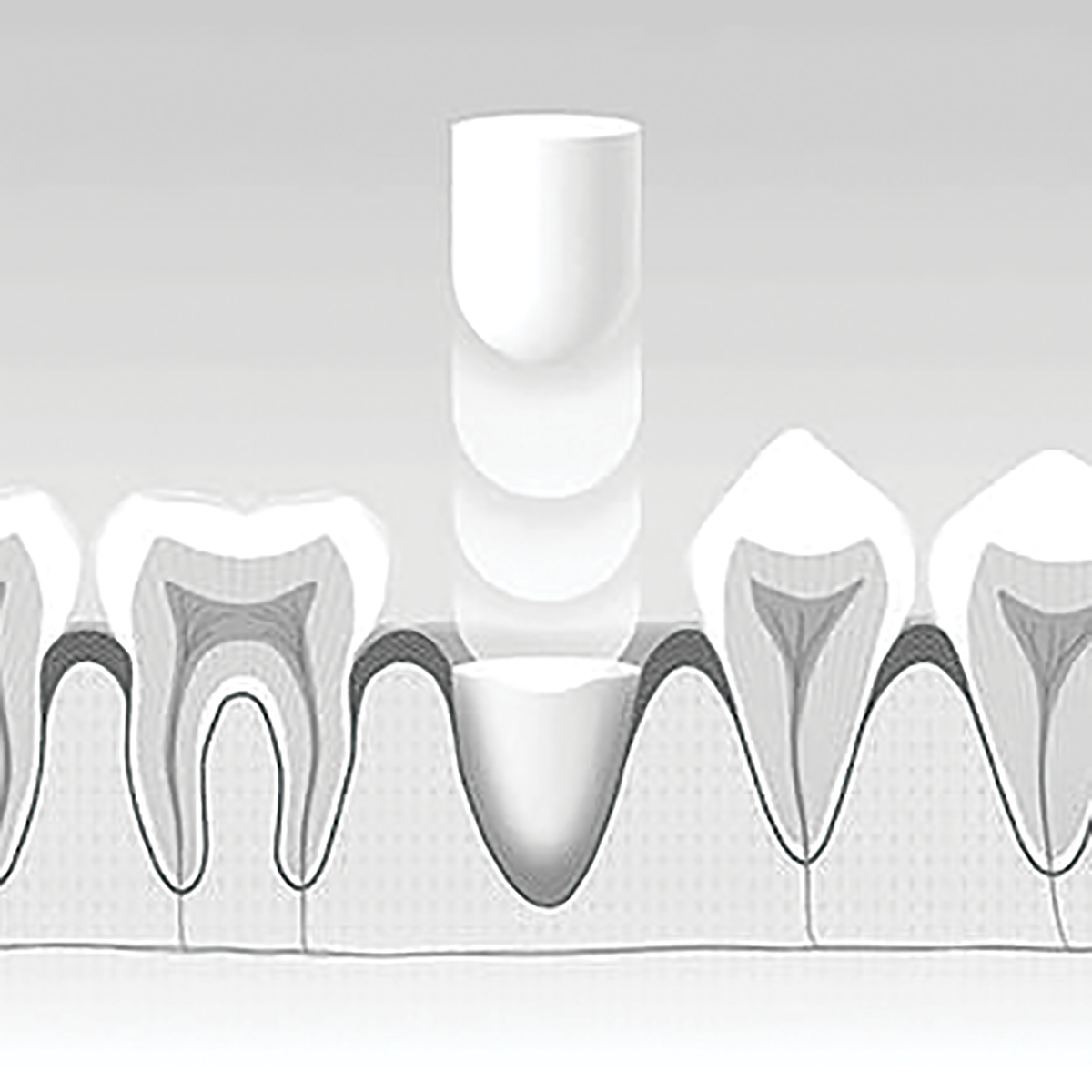 J. Morita Foundation Bone Grafting Material