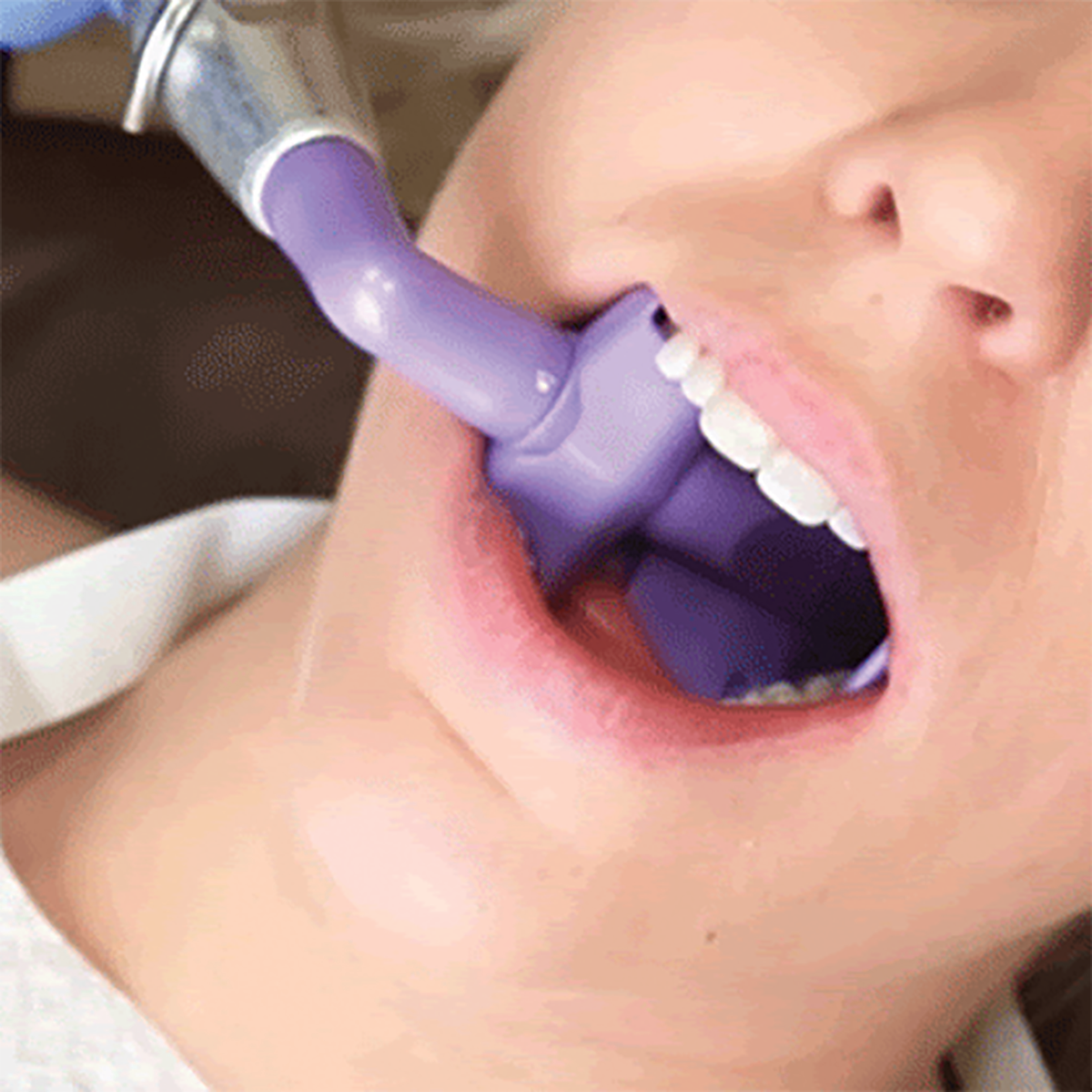 Suction & Retraction Inside the Mouth Using Mr. Thirsty