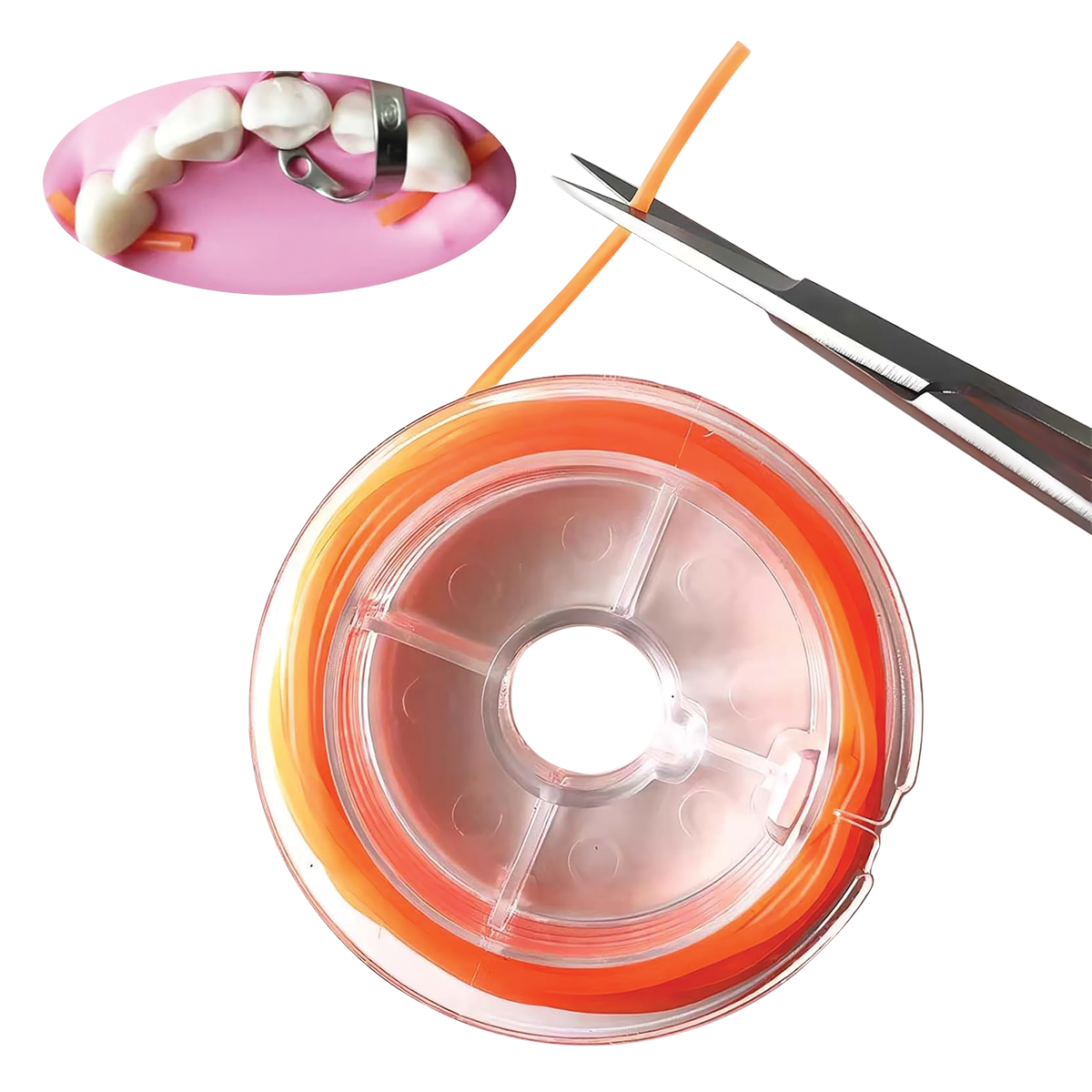 Cutting of Rubber Dam Stabilizing Cord