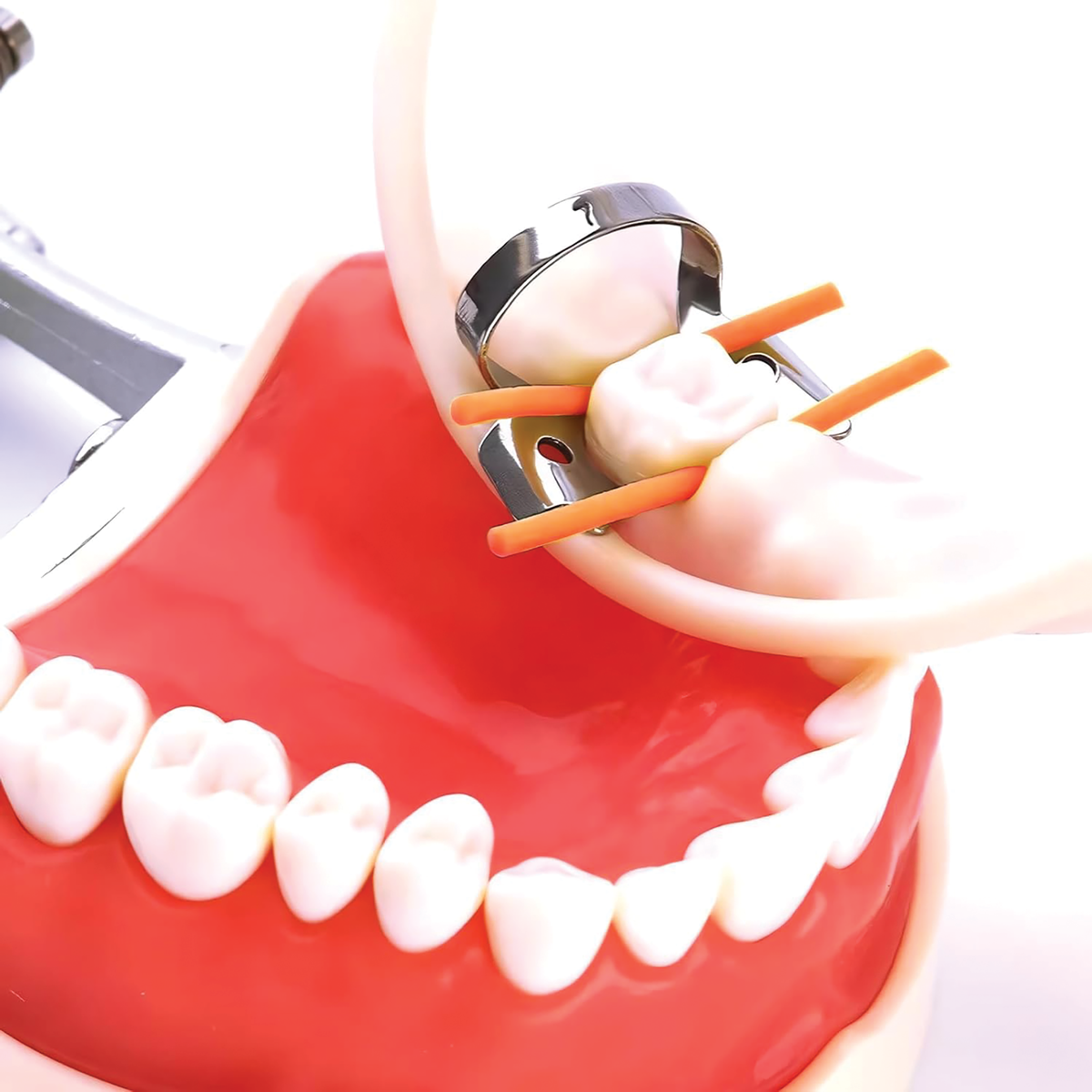 Using Rubber Dam Stabilizing Cord