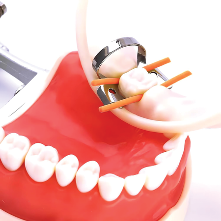 Using Rubber Dam Stabilizing Cord