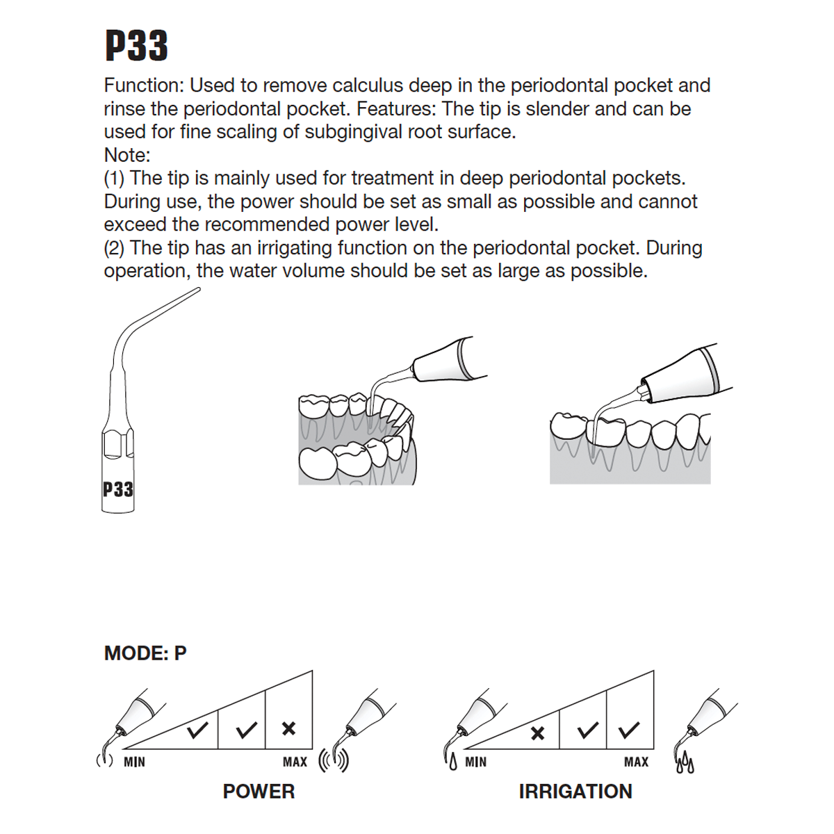 P33 Tip
