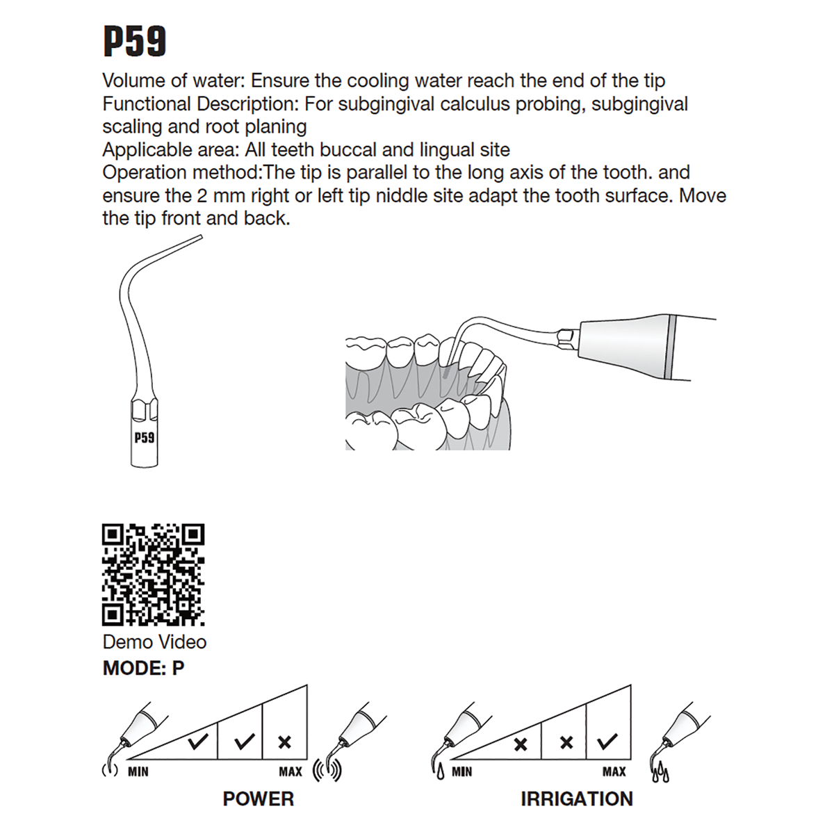 P59 Tip