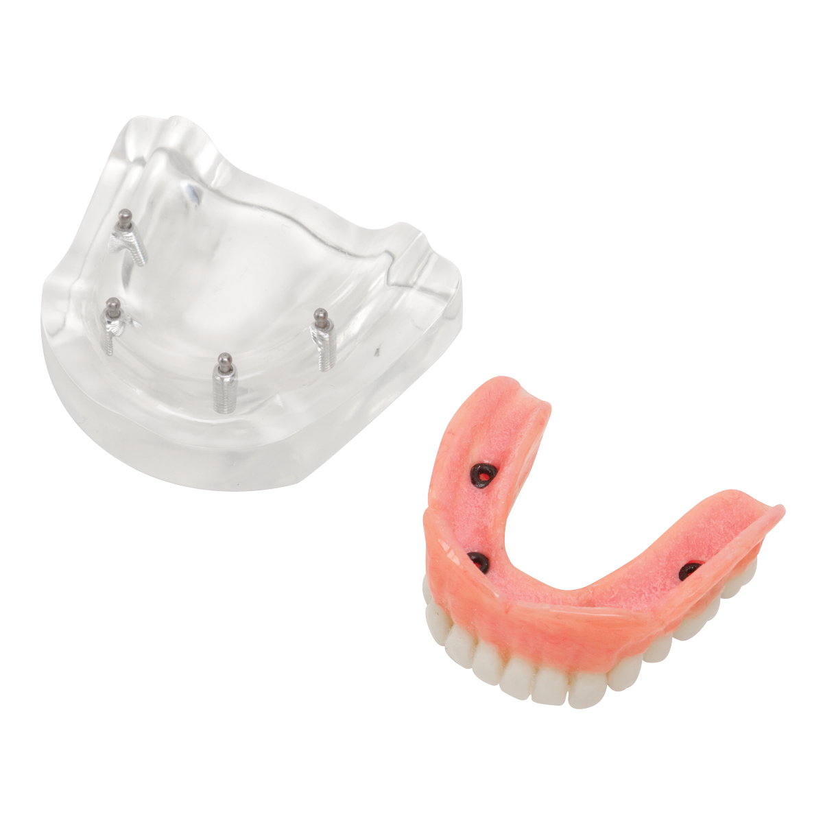 Lower Overdentures Model (4 Implants)