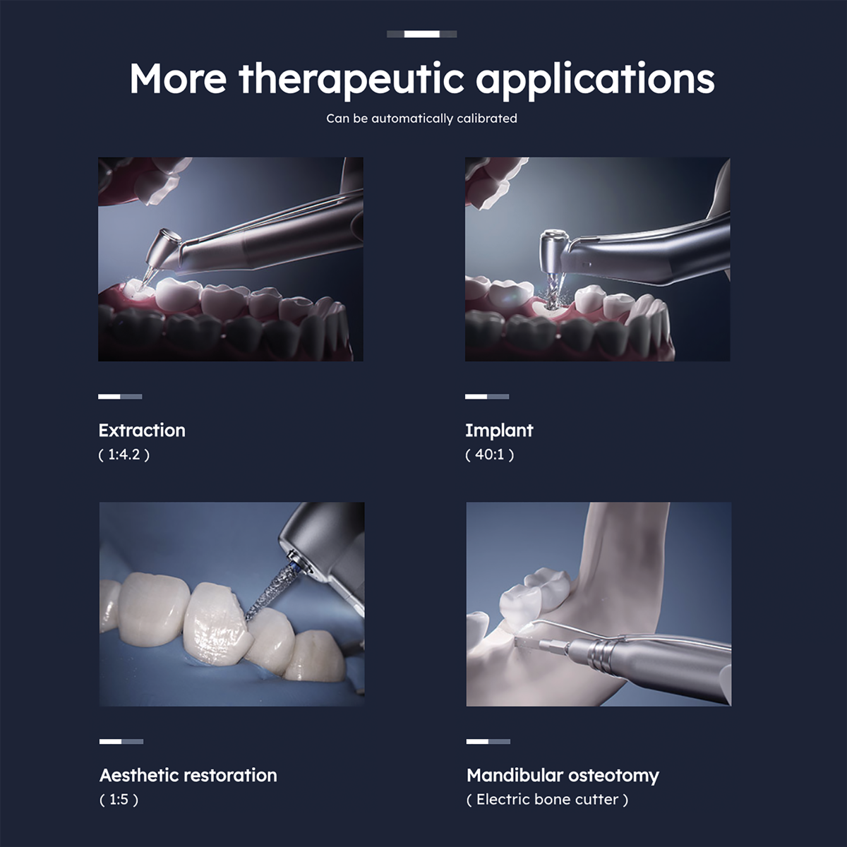 ES70 Surgical Handpiece System - Additional View