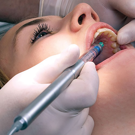 Palatal Program Method