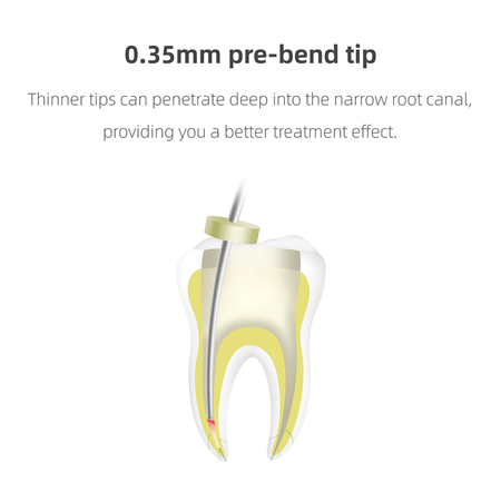 Thinner Tips