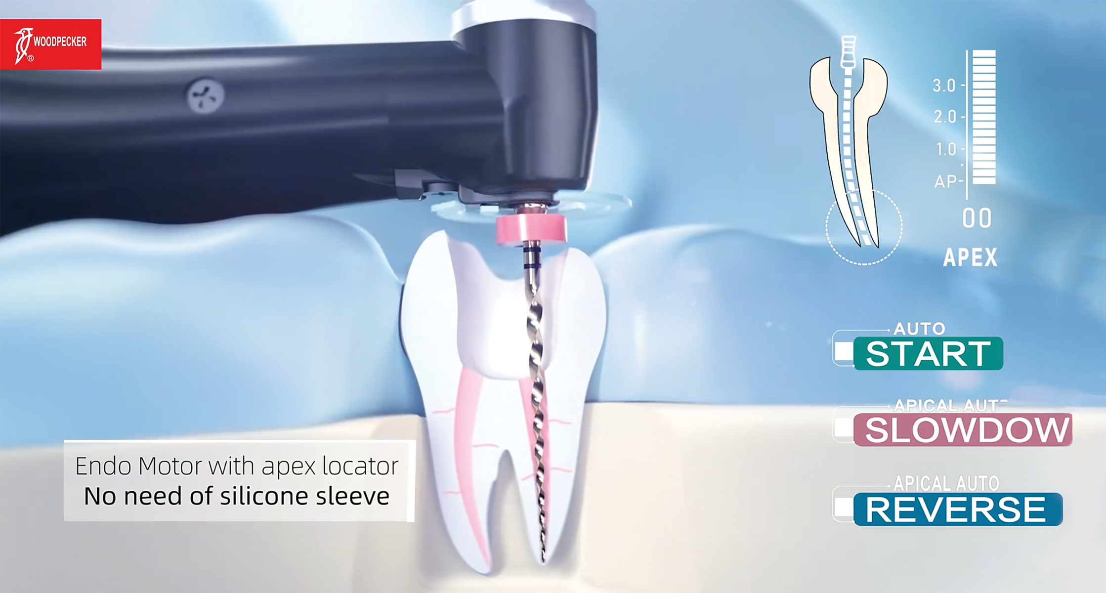 Endodontic Apex Location