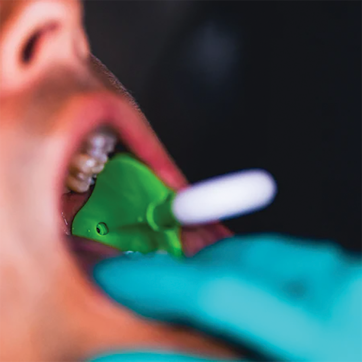 Suction System in a Patient
