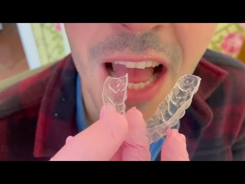 Parkell Video on Using Blu-Mousse and Mach to Make Whitening Trays Chairside