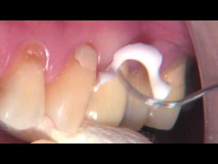 Video on Cleaning Up the Ceramir C&B QuikMix Cement