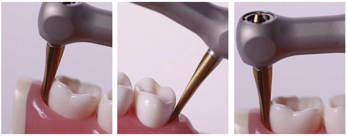 Technique for Handpiece