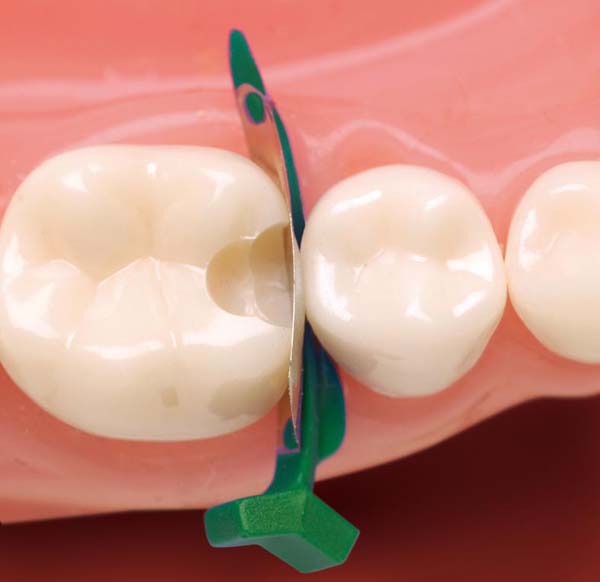 FenderMate Between Teeth