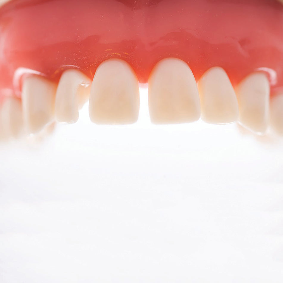 ProxyPal 3D Anterior Matrix Strips