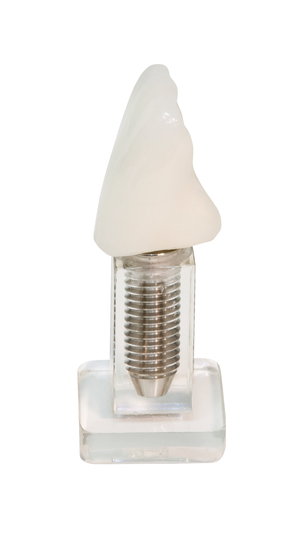 Single Tooth Implant Model