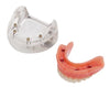 Locator Zest Denture Model - 4 Implants