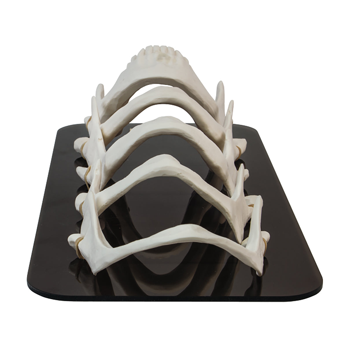 Mandible Bone Loss Model