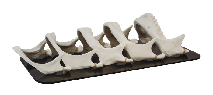 Mandible Bone Loss Model