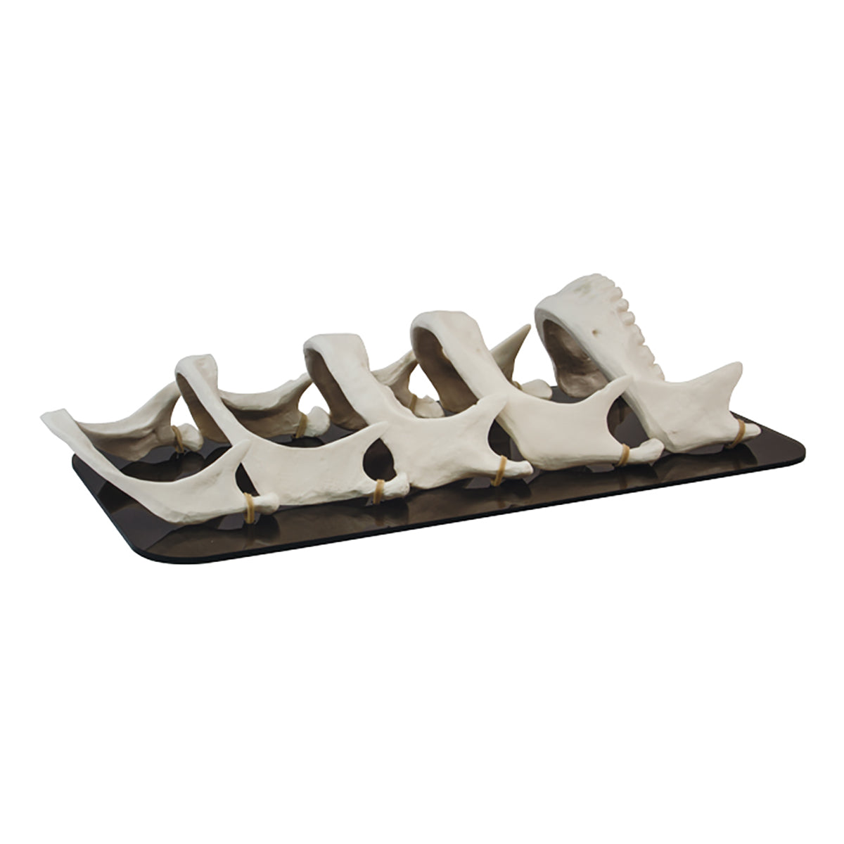 Mandible Bone Loss Model