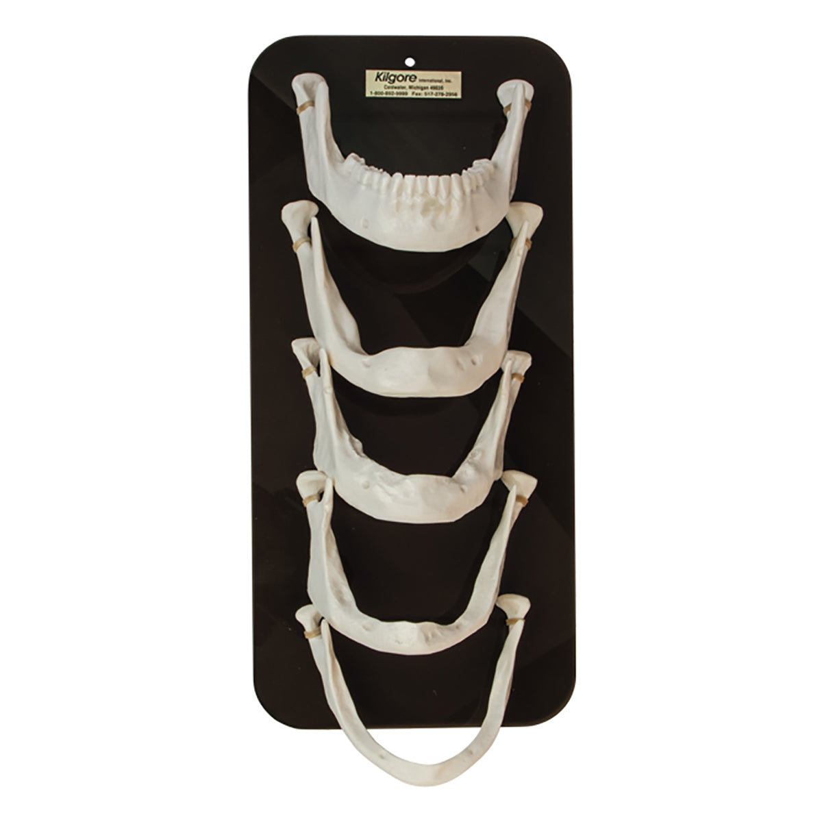Mandible Bone Loss Model