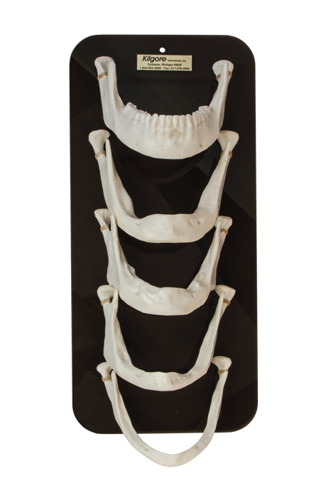 Mandible Bone Loss Model