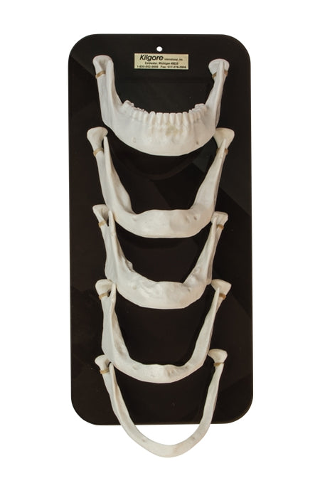 Mandible Bone Loss Model