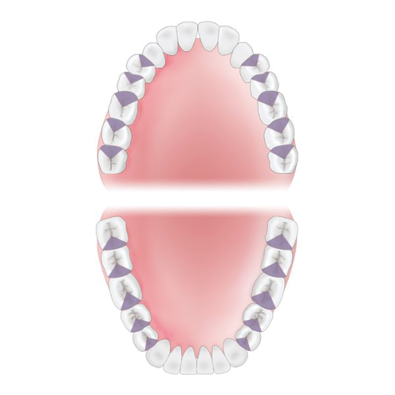 Mesial Area of Mouth