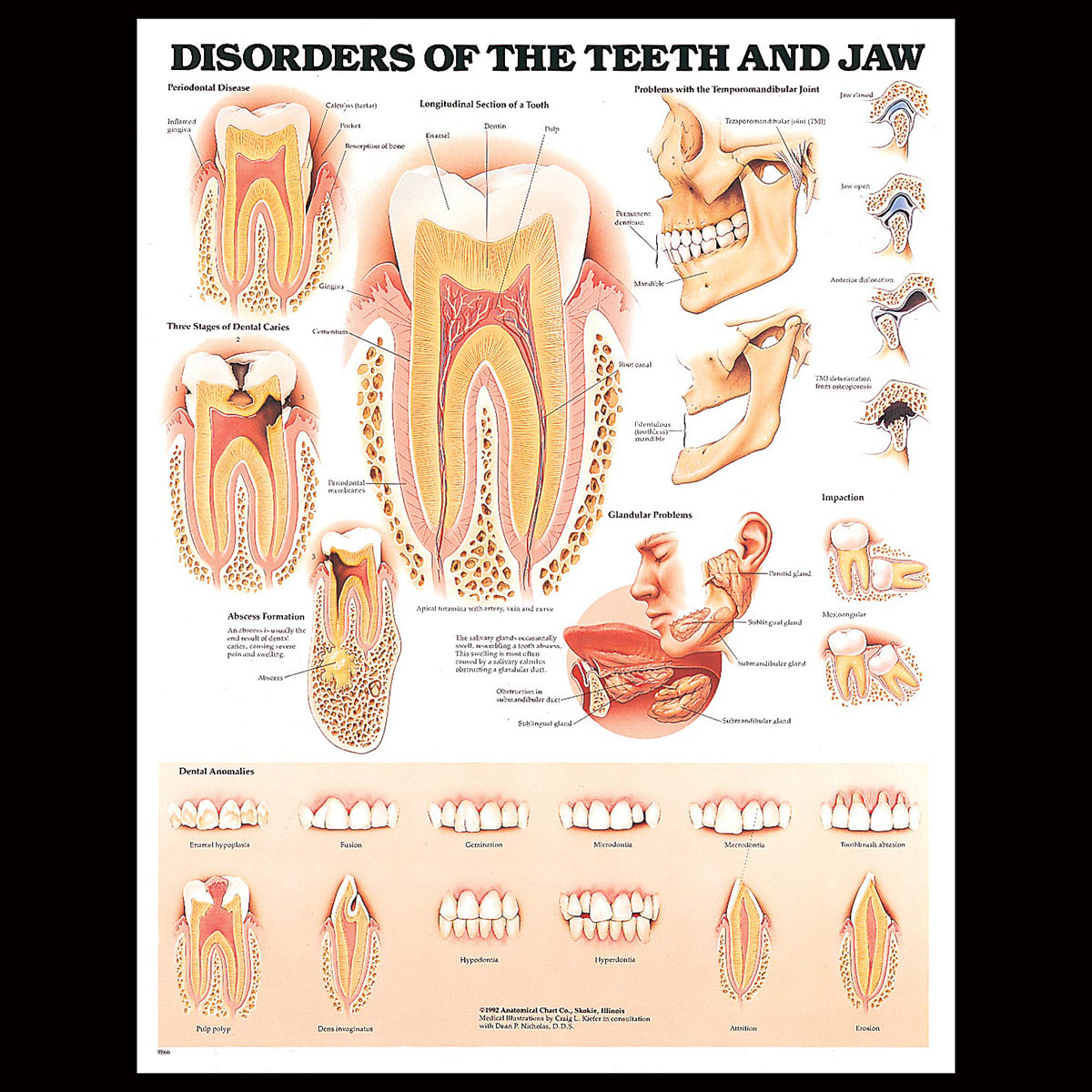 Disorders Of The Teeth & Jaw Chart