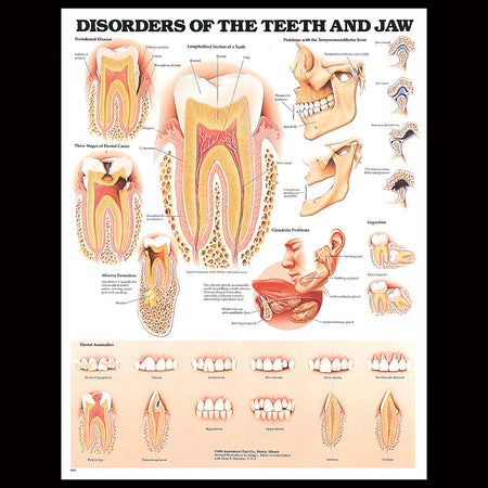Disorders Of The Teeth & Jaw Chart
