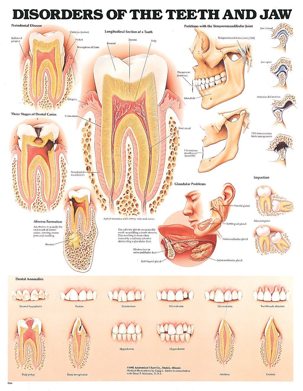 Disorders Of The Teeth & Jaw Chart