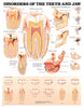 Disorders Of The Teeth & Jaw Chart