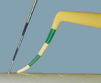 PDT EasyView Probe 3-6-9-12 - American Dental Accessories, Inc.