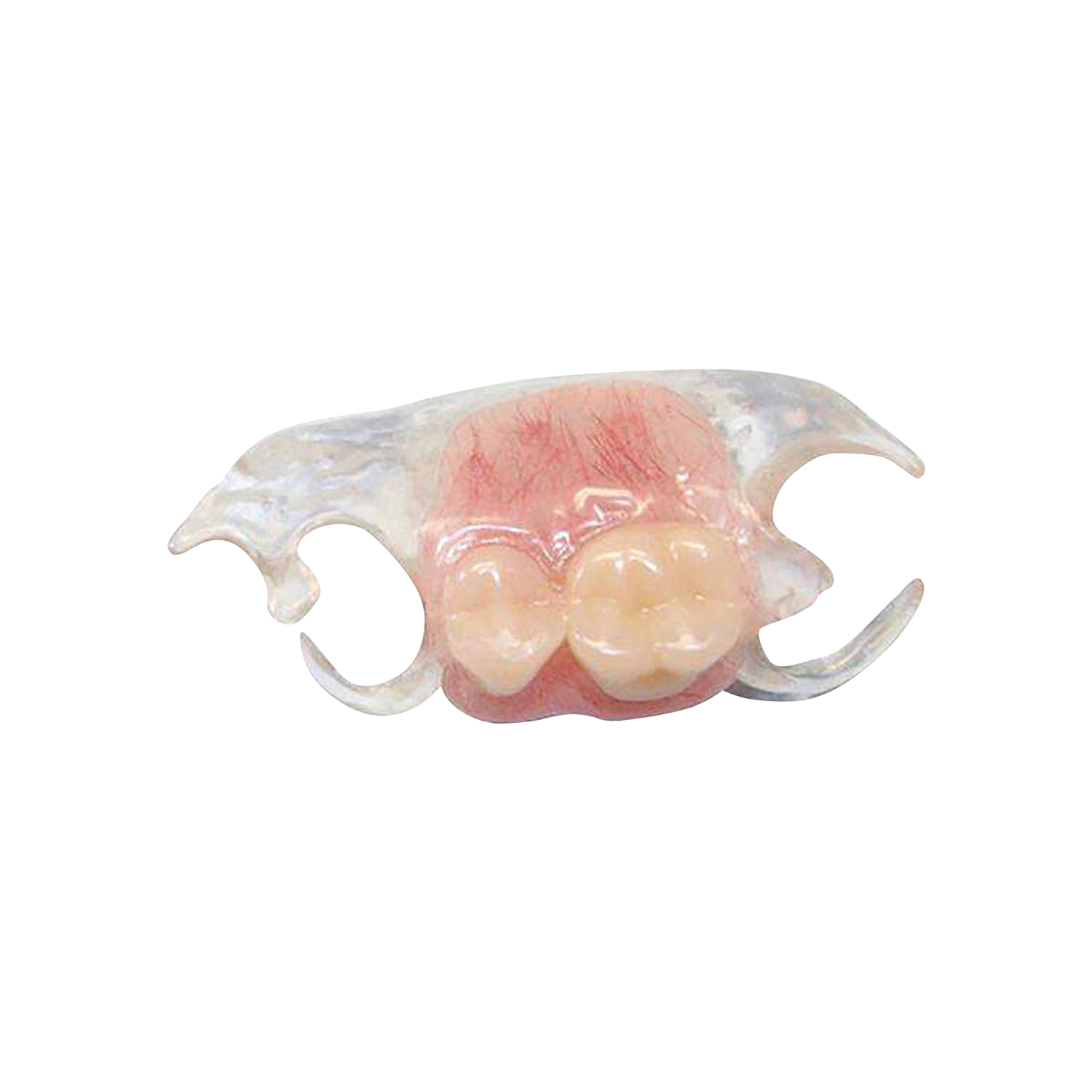 Clearmet Thermoplastic Resin for Partials (Medium)