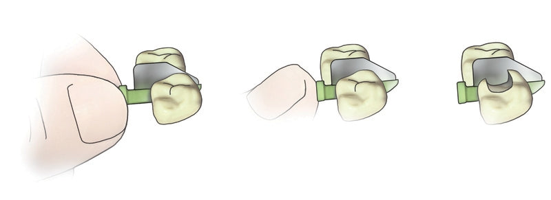 FenderWedge Diagram